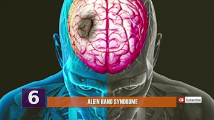 STRANGEST Medical Conditions!