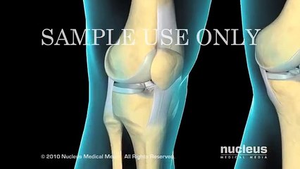 Orthopaedic Surgery in Amman Jordan - Dr. Ghassan Khayyat