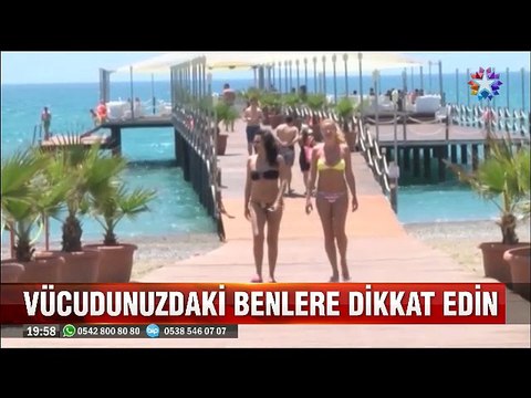 Her ben riskli değil ama Avuç içi ve Ayak tabanındaki benlere dikkat