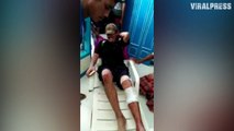 Tourist Rescued After Being Bitten By Komodo Dragon