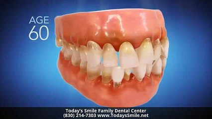 Invisalign Dentist New Braunfels TX