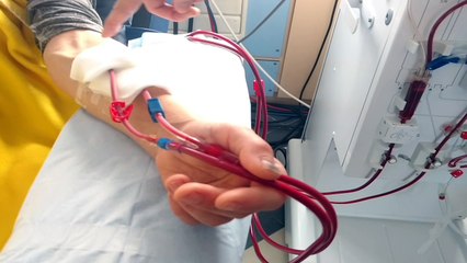 Hôpital Joseph Wauters à Waremme: un service d'auto-dialyse dernier cri