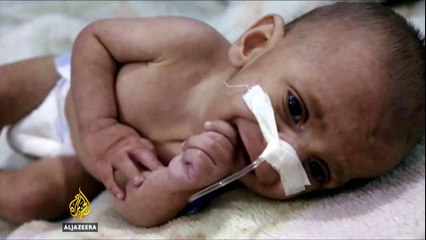 Syrian children's deadly hunger crisis worsens as aid groups blocked