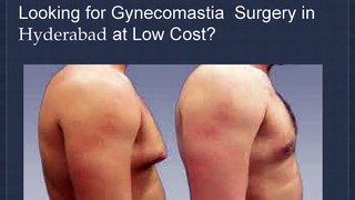 Gynecomastia Cost in Hyderabad | Gynecomastia Hyderabad