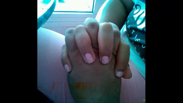 cheb Khalas ( elbereh gabdhat elvol ) , الشاب خلاص ( البارح قبضت الفول )