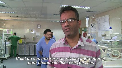 Appel pour une opération à l'étranger de siamoises nées à Gaza