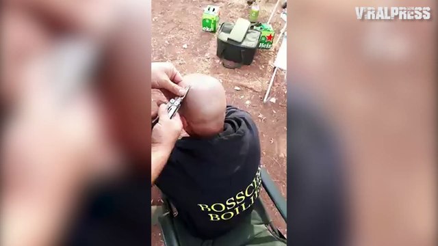 Angler Has Fishing Hook Removed From His Head