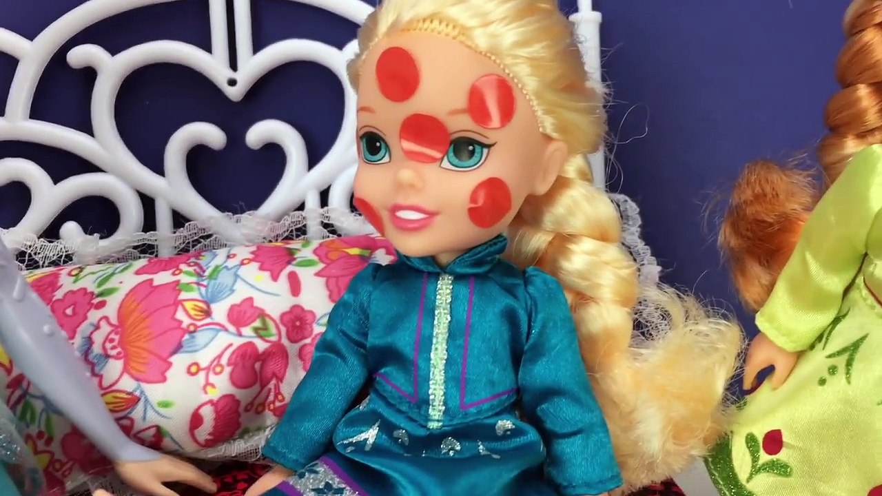 Frozen Elsa Toddler Gets the Chicken Pox! With Frozen Anna Plus My Little Pony and More