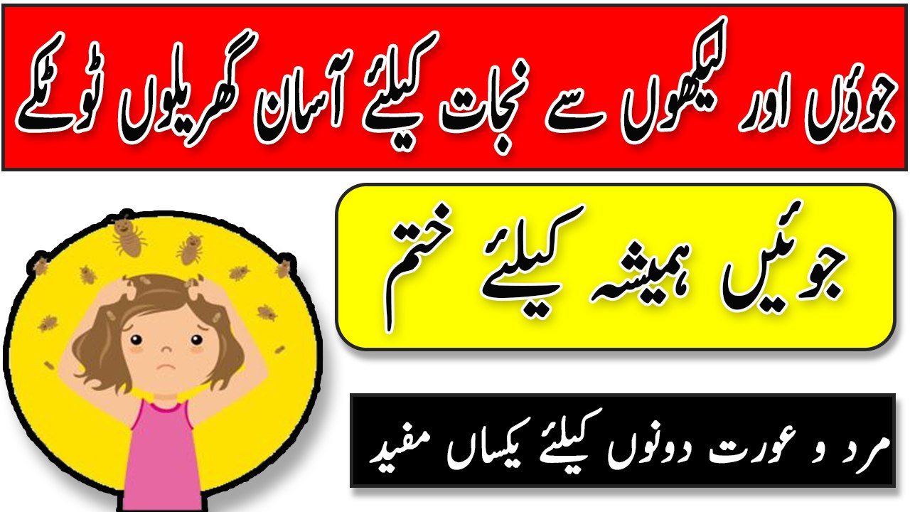 Sir ki juon ka Mukamal Khatma  - Head Lice Treatment In Urdu -  How To Get Rid Of Head Lice