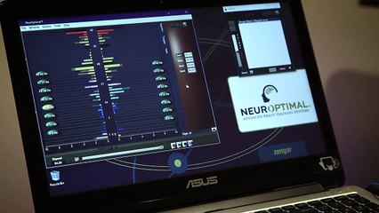 Mental Health Treatment|NeurOptimal Brain Training in Michigan