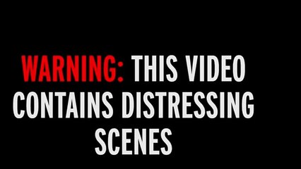 Vdes politikani i njohur, theu shtyllën kurrizore në një park lojërash