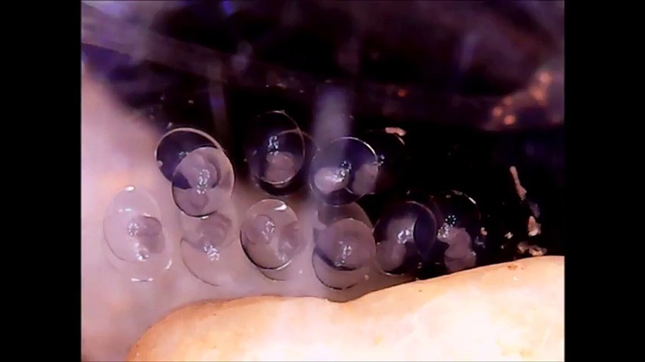 Microscopic Time Lapse of fresh water snail eggs - Clutch 2