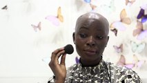 How Burn Survivor Shalom Blac Learned to Love Her Flaws _ Glamour-1xAxADx4mKw