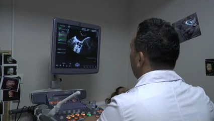 Bebeklerde Sendrom Riski Tarih Oluyor