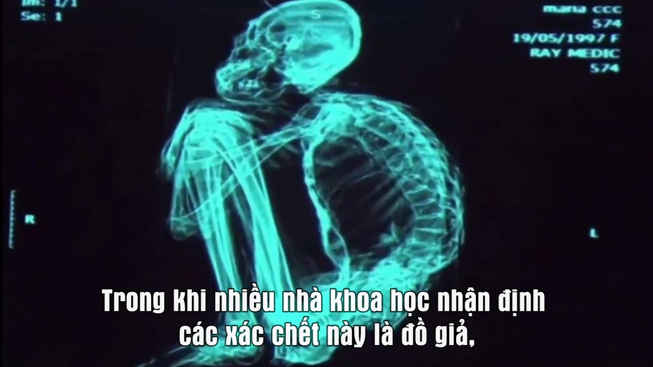 Loạt xác ướp ở Peru thật sự là xác của người ngoài hành tinh?