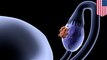 Kanker rahim: ditemukan mutasi sel kanker rahim di tuba falopi - TomoNews