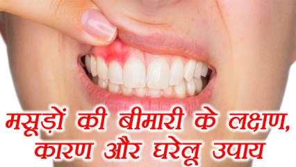 Gums Disease Symptoms & Treatment | मसूड़ों की बीमारी के लक्षण, कारण और घरेलू उपाय | Boldsky