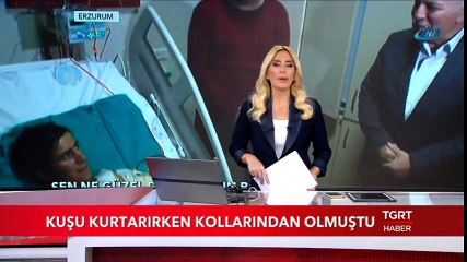Kuşu Kurtarırken Kollarından Olmuştu