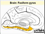 Capgras Syndrome and the Fusiform Gyrus
