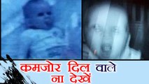 Bizarre: Parents share these horrifying pictures of their children | वनइंडिया हिंदी