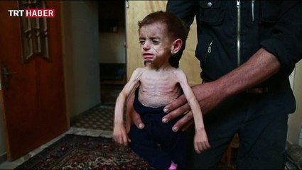 Doğu Guta açlığın pençesinde