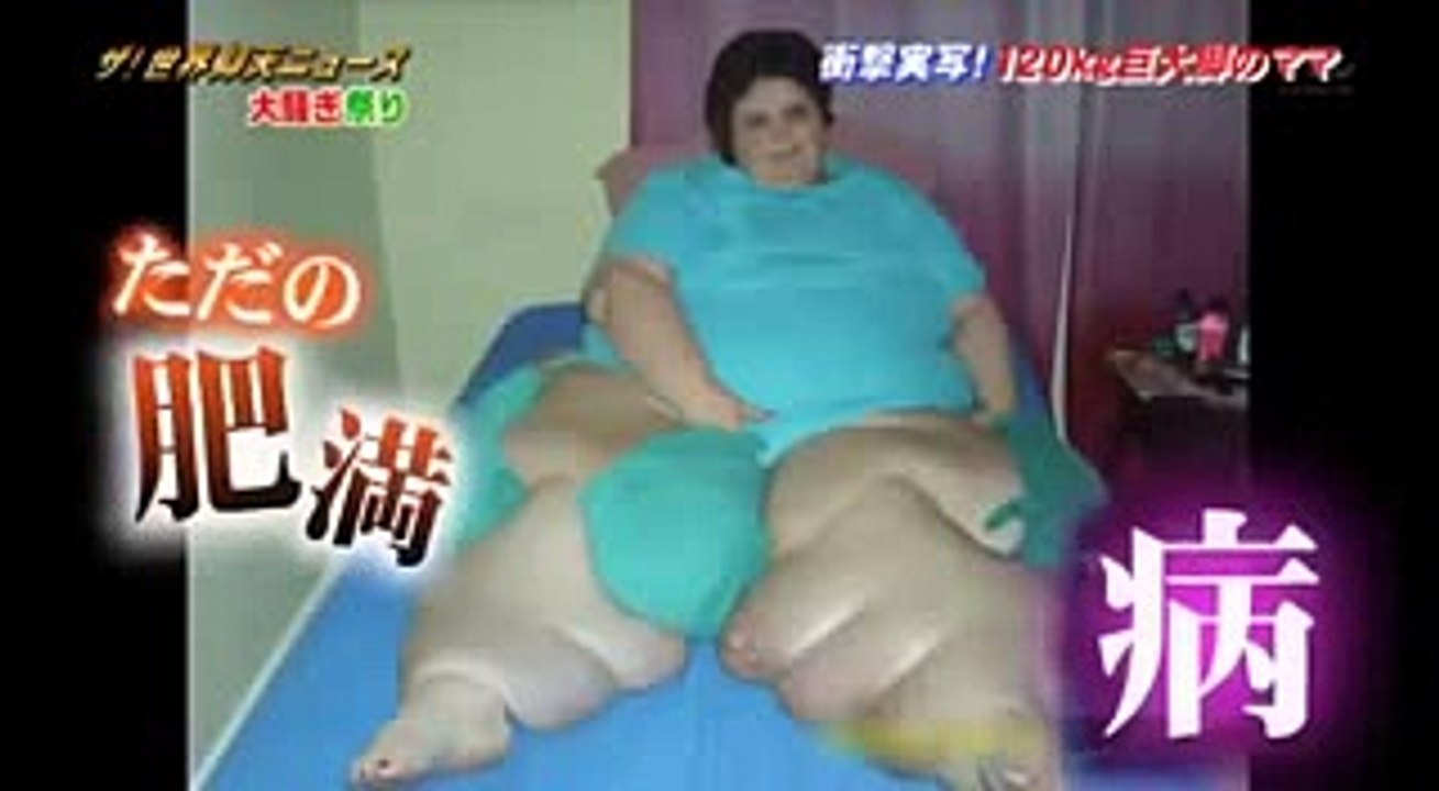 世界仰天ニュース【死を覚悟した巨大腹】2013年11月13日