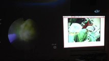 Canlı Yayında Robotik Cerrahiyle Prostat Ameliyatı