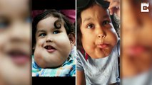 Brave boy battling massive watermelon size tumours in his face that could choke him to death defies bullies who call him ‘monster’