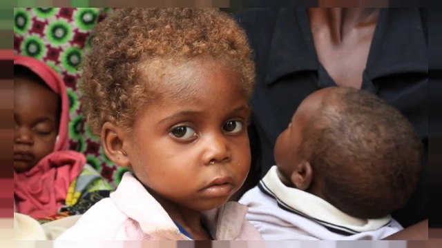 Milhares em risco de morrer de fome na RD Congo, avisa ONU