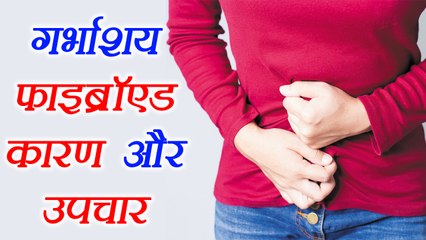 Uterine Fibroid: Reason and treatment | गर्भाशय फाइब्रॉएड के कारण और उपचार | Boldsky