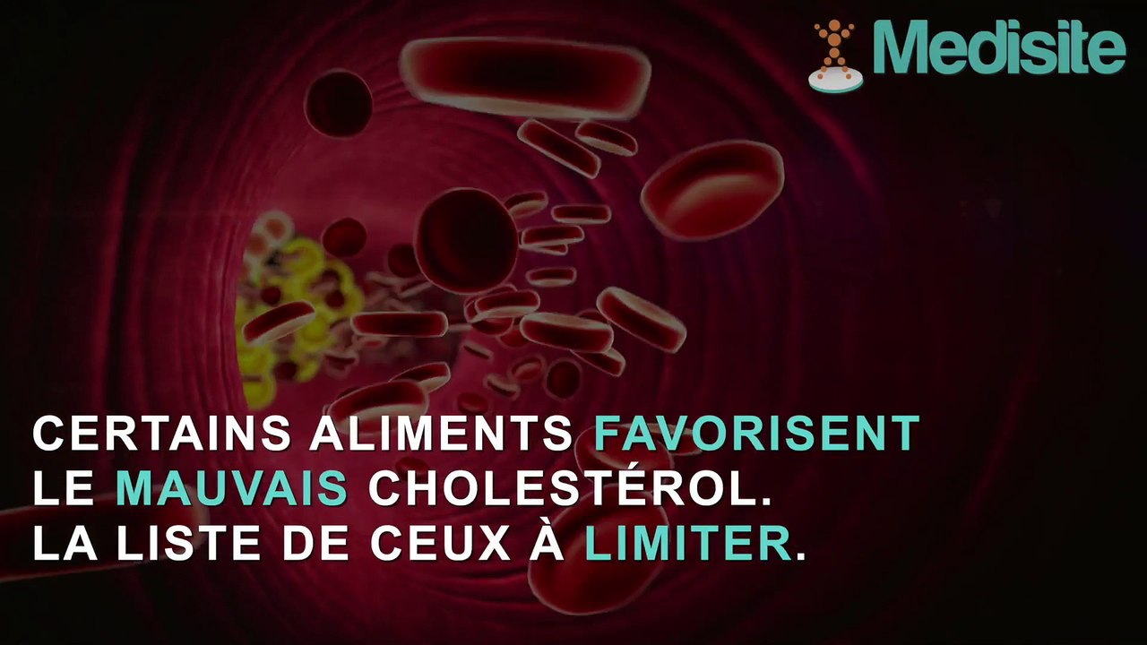 Cholestérol : top 3 des aliments à oublier