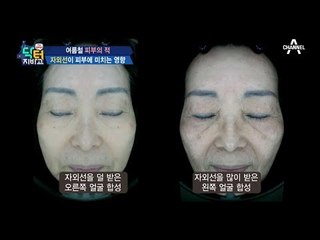 여름철 피부의 적, 자외선이 피부에 미치는 영향!