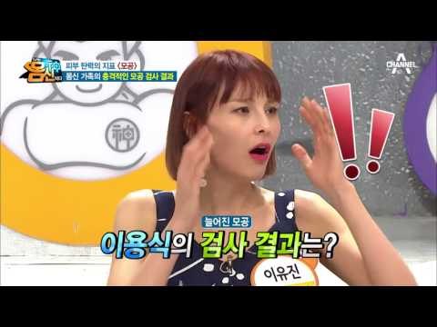 피부 탄력의 지표 [모공] ! 몸신 가족들의 모공 검사 결과는?