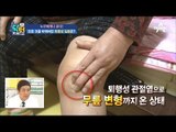 내 무릎은 내가 지킨다! 퇴행성 관절염 막는 자가진단법!