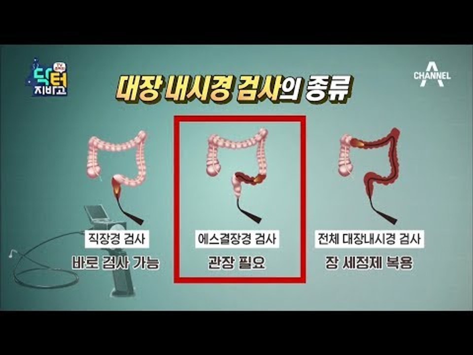 병원이 너무 무섭다?! 초간단 대장암 예측 ‘간이 검사지’와 맞춤형 대장 내시경!