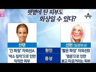 탄 줄 알았던 내 까만 피부, 알고 보니 햇빛 화상?
