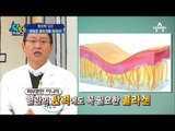 노화증상의 원인은 '콜라겐 부족'?! 점점 줄어드는 체내 콜라겐!