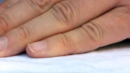 Ny flåt fundet i Danmark - kan være livsfarlig for husdyr og dig - TV2 03-11-2017