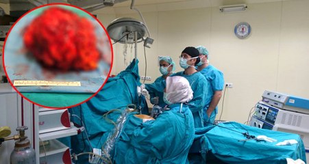 Dünyada İkinci Kez Rastlanıyor! Hastanın Böbreğinden 20 Santimlik Tümör Çıkarıldı