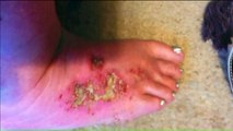 Woman Says Pedicure Left Her with `Shooting Pain Like Knives`