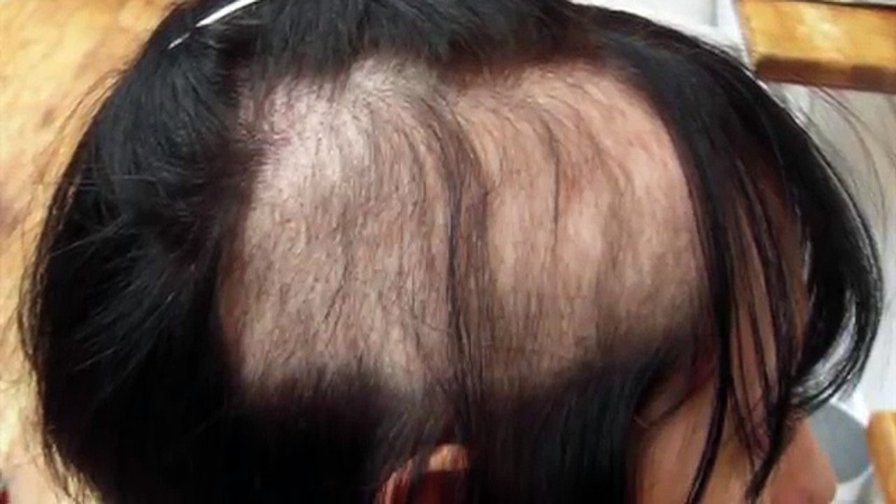 Top 5 weirdest mental disorders