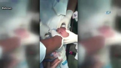 Boğazına Saat Kordonu Kaçan Çocuk Böyle Kurtarıldı