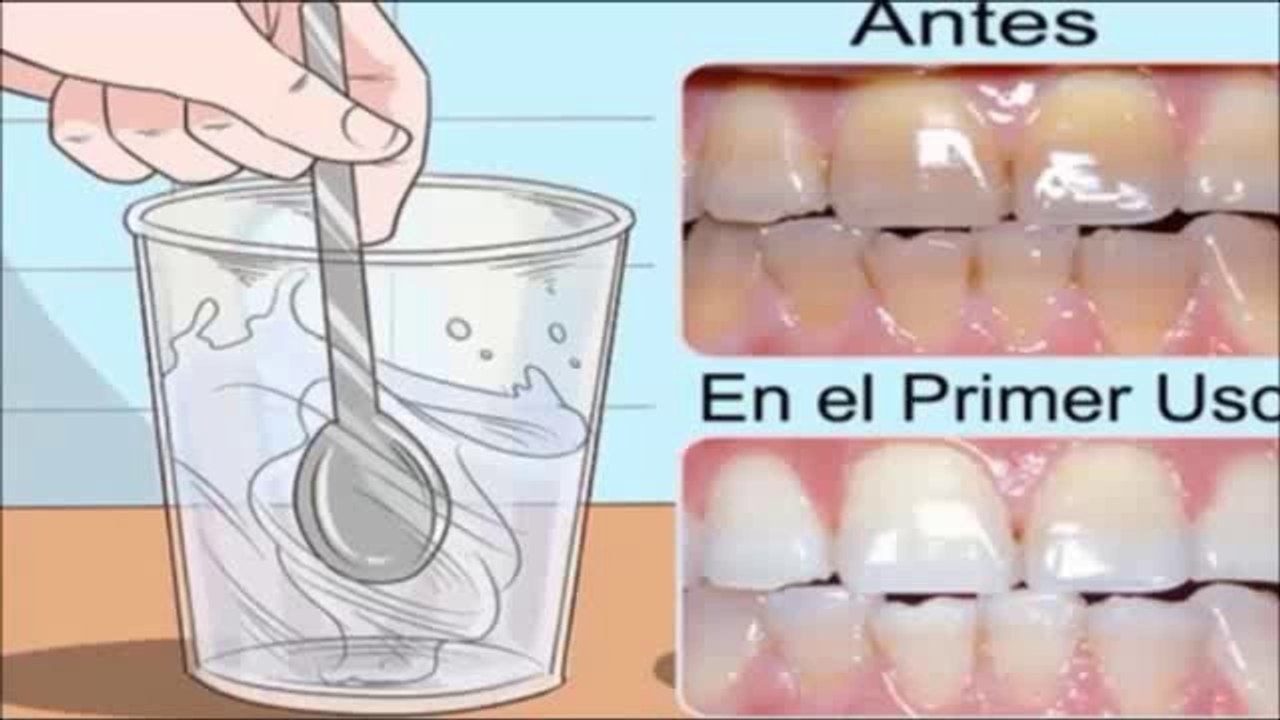 Solo use una gota de este remedio y blanqueo mis dientes, elimino el sarro, hongos