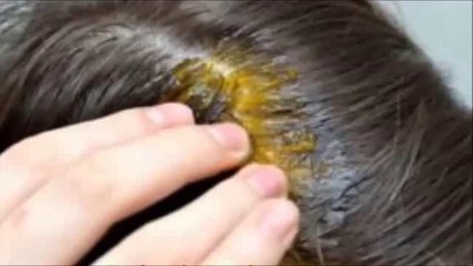 Con este ingrediente te crecerá el pelo, las cejas y las pestañas