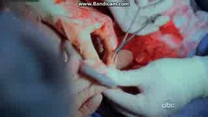 Private practice 3x23 dell's death