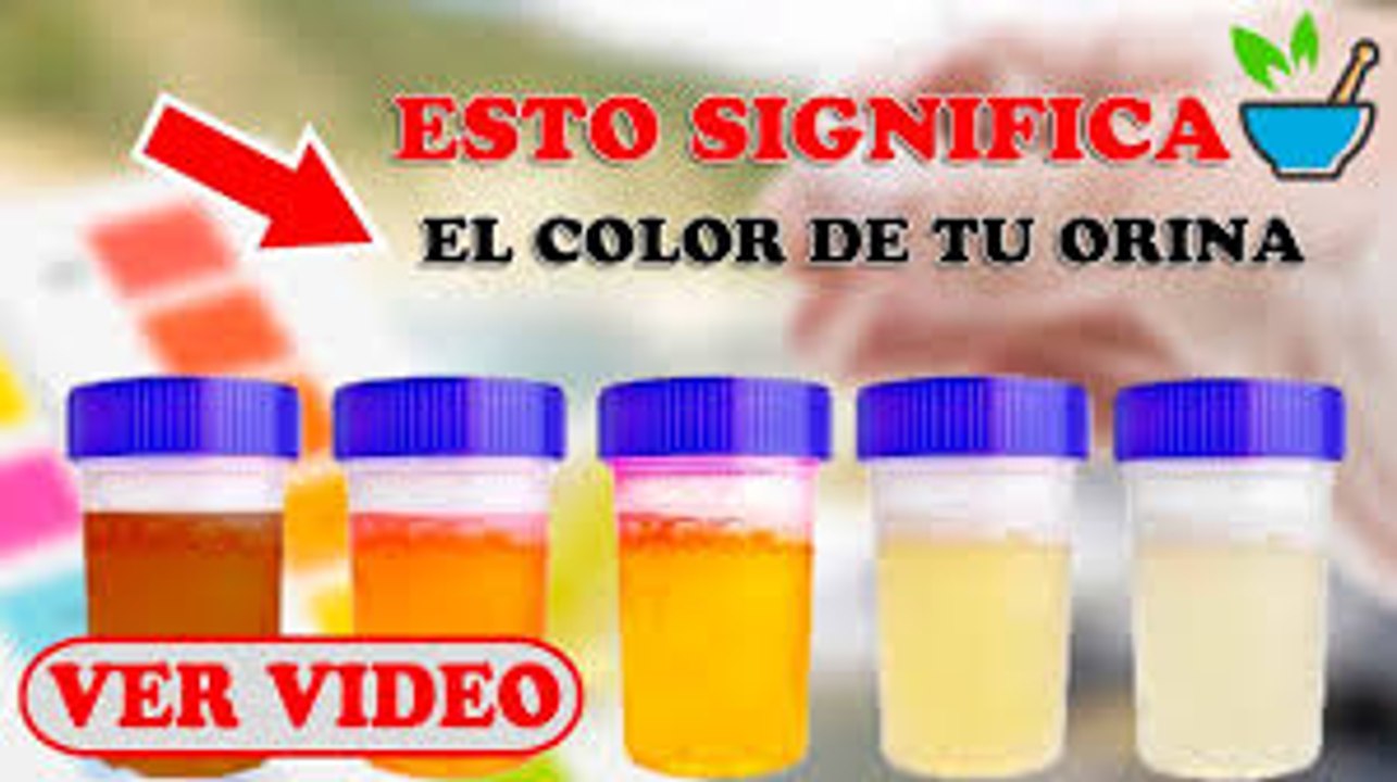 El Color De la Orina Dice Todo Sobre TU Salud ¡ESTO Es Lo Que Significa Su Color y Que Podría Andar