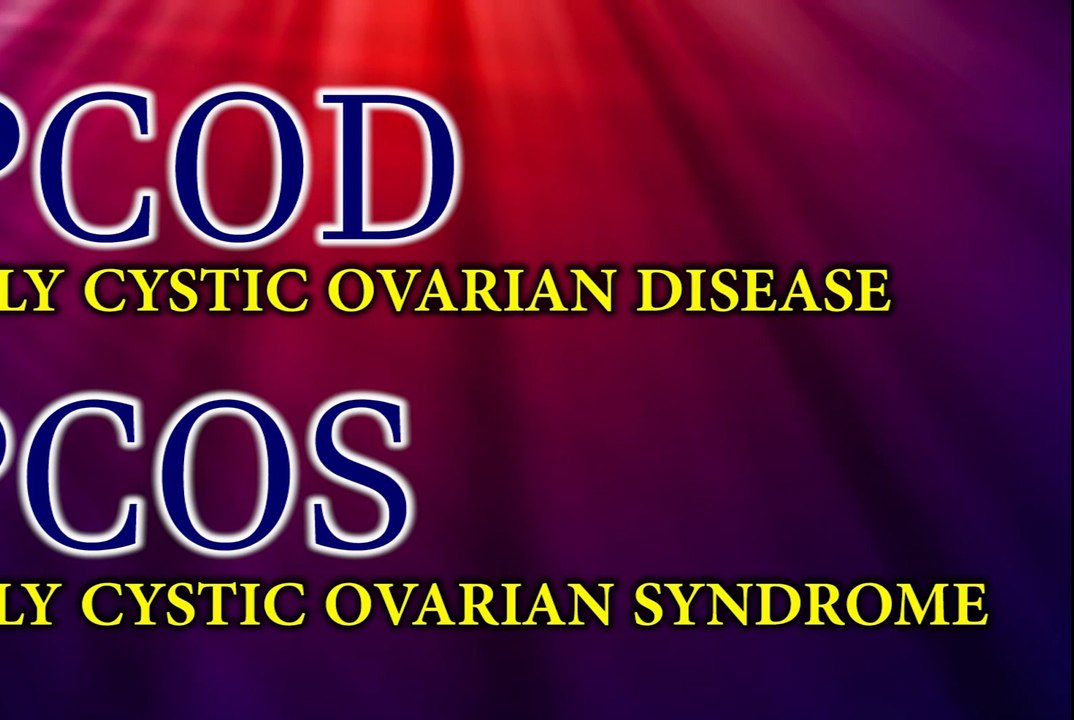 Home Remedies for Poly cystic Ovarian Syndrom PCOD PCOS