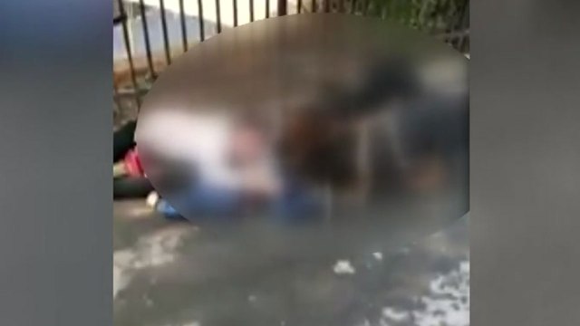 [영상] 목줄 없는 맹견으로부터 손자 지키려는 할머니 / YTN
