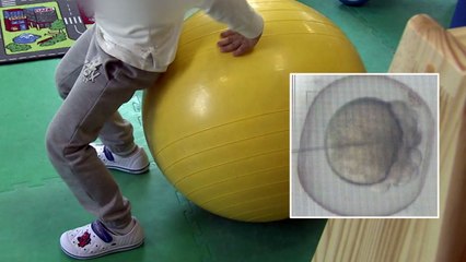 자폐증 원인유전자 규명...치료제 개발 실마리 / YTN