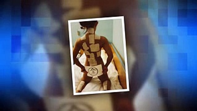 キンタロー。　社交ダンス・ドイツ大会の思い出振り返り、全裸湿布写真も公開